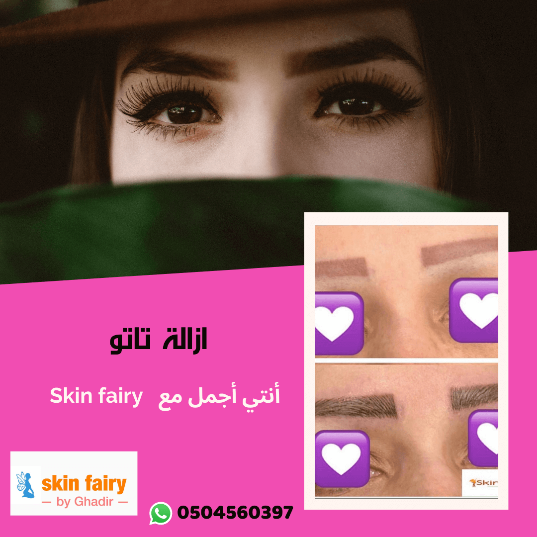 skin fairy | تصميم خبراء التسويق الالكتروني | شيماء المهدي